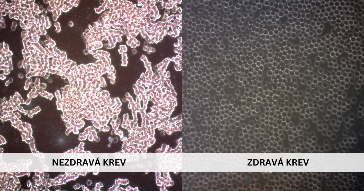 ŠPATNÍ KREV (1)